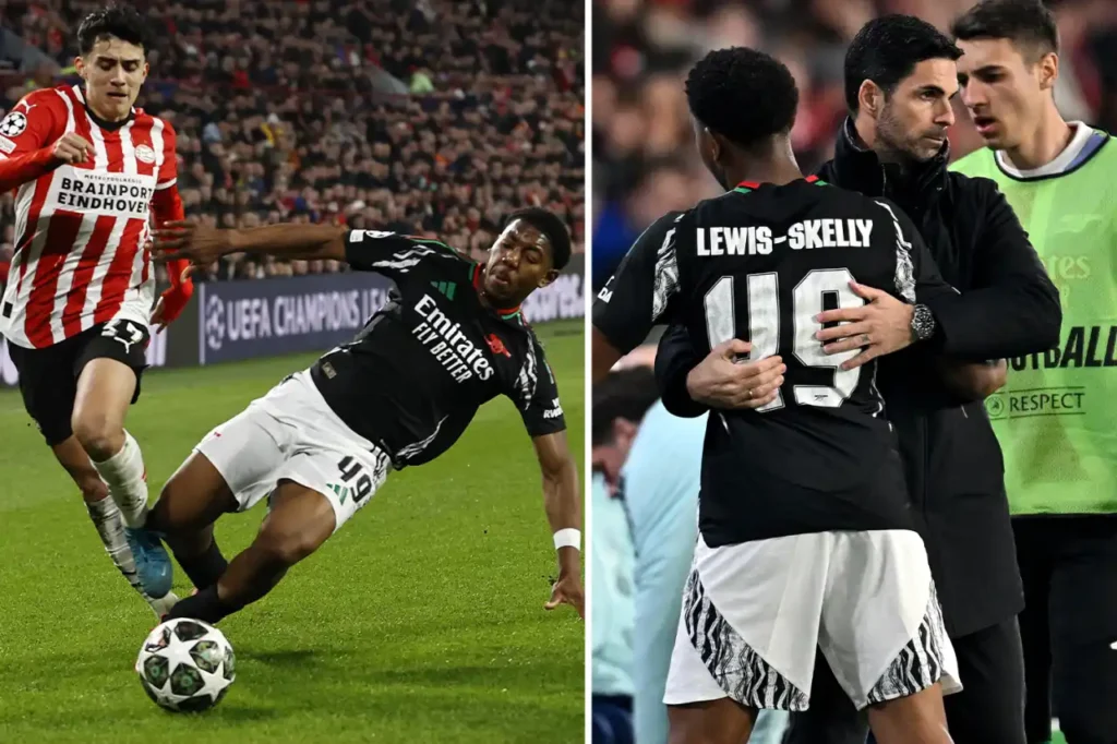 MYLES LEWIS-SKELLY was dragged off just 34 minutes into Arsenal's Champions League clash against PSV.